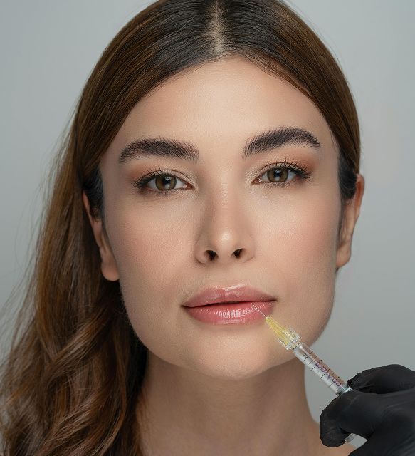 Dermal filler injection at the corner of the lips for subtle definition
