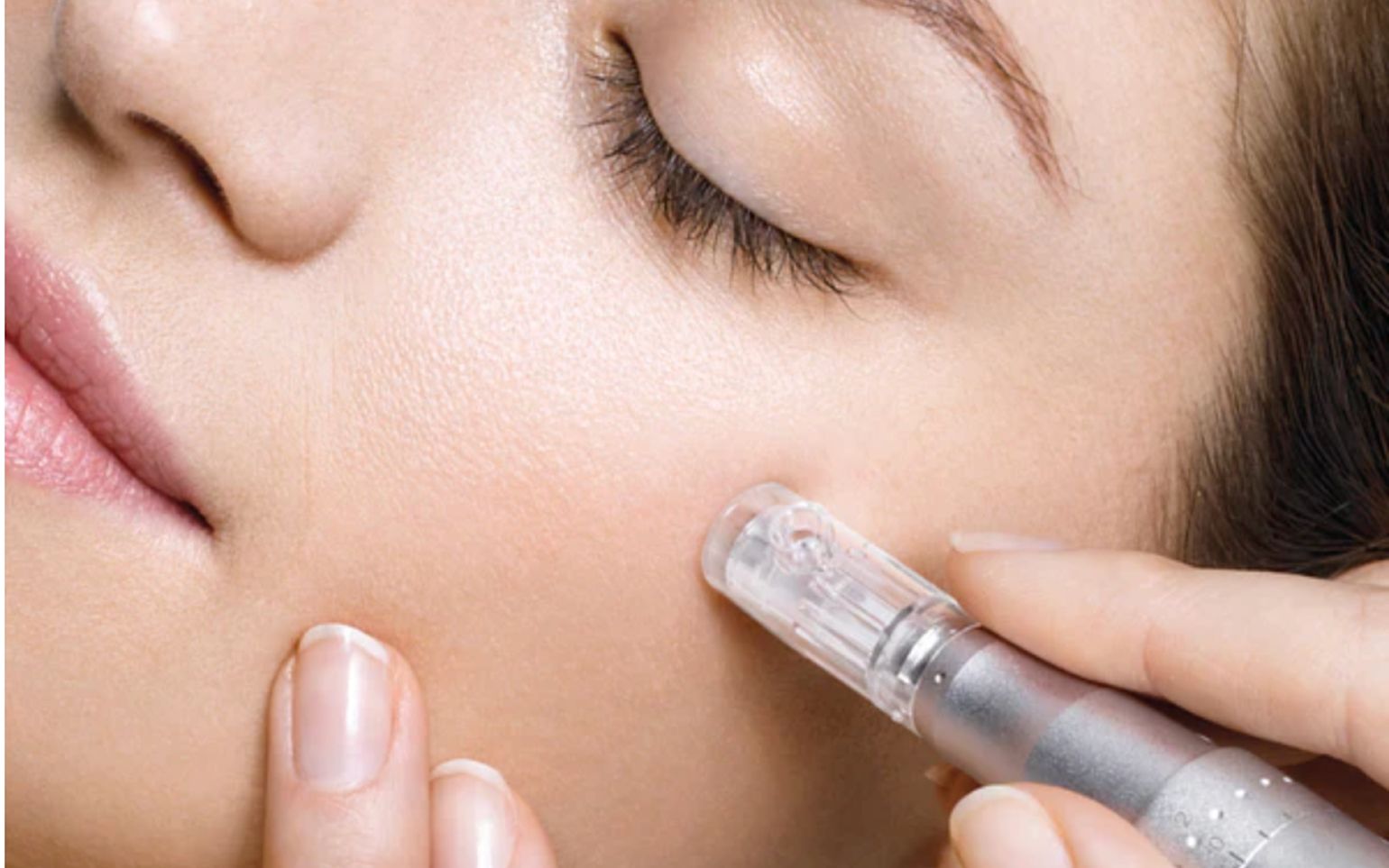 Microneedling pen treating the skin beside a client's closed eye