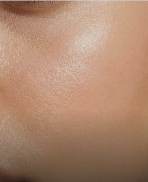 Close-up of smooth, even skin texture after a hydrating treatment